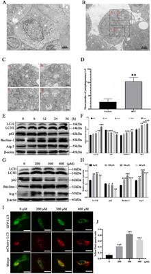 Monocrotaline-mediated autophagy via inhibiting PI3K/AKT/mTOR pathway induces apoptosis in rat hepatocytes